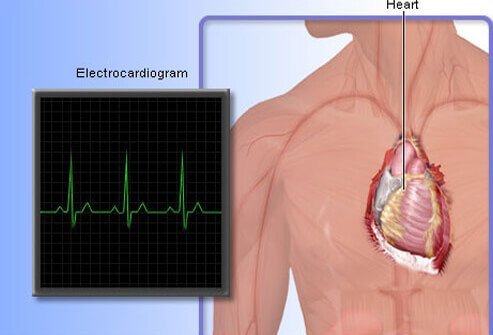 heart_disease_s11_electrocardiogram.jpg