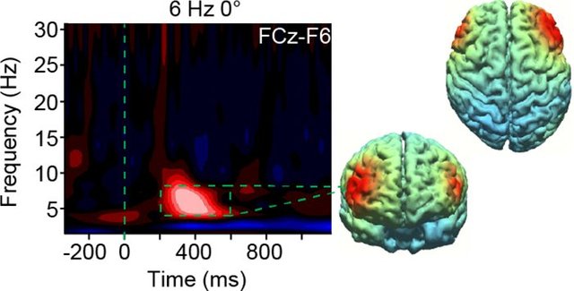 aa-brain-scan-2.jpg