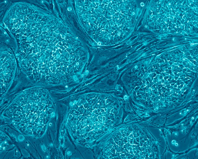 Human_embryonic_stem_cells.jpg