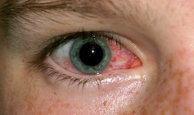 auge-760x450.jpg