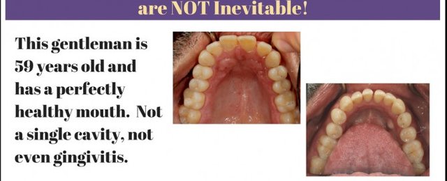 Cavities-and-Gum-Disease-Not-Inevitable-669x272.jpg