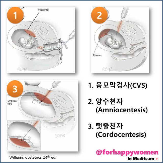 슬라이드3.JPG