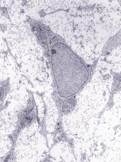 Mesenchymal stem cell