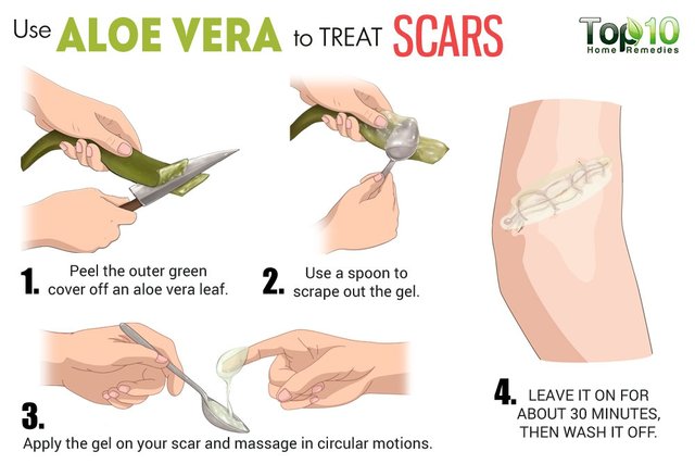 0-aloe-vera-to-treat-scars.jpg