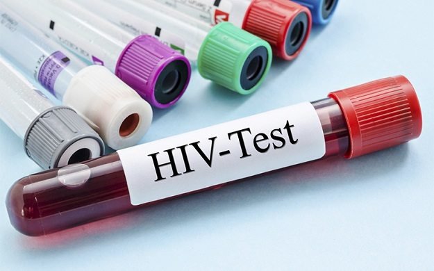 the-evolution-of-HIV-testing-shutterstock.jpg