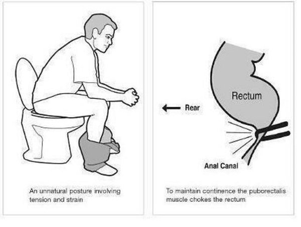 You've Been Sitting On The Toilet Wrong Your Whole Life. This Is How To Do It Right. (2).jpg