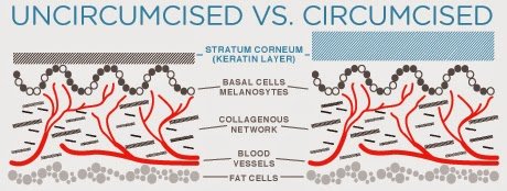 circumcision.jpg