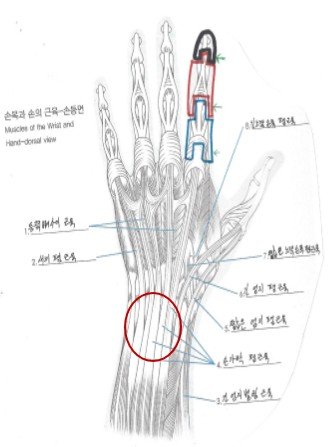 손가락폄근 (2).jpg