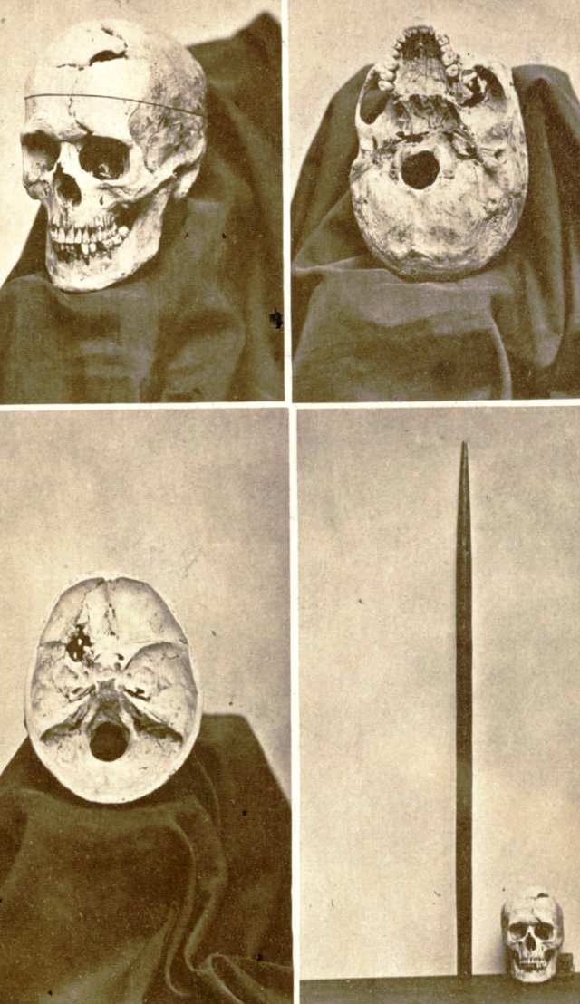 JacksonJBS_A_descriptive_catalogue_of_the_Warren_Anatomical_Museum_1870_frontispiece_623x1024.jpg