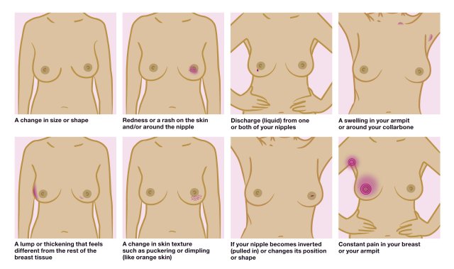 breast-awarenes-large (1).jpg