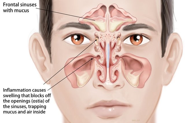 sinus-infection-1-1024x685.jpg