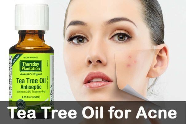 How-to-Use-Tea-Tree-Oil-for-Acne.jpg