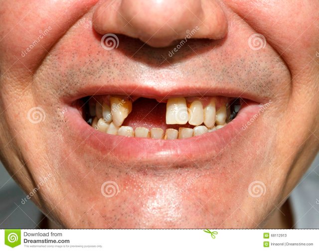 sonrisa-sin-los-dientes-68112913.jpg