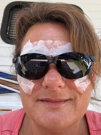 small lasik 2.jpg