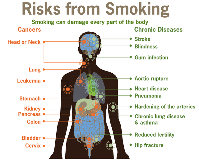 1200px-Risks_form_smoking-smoking_can_damage_every_part_of_the_body.png