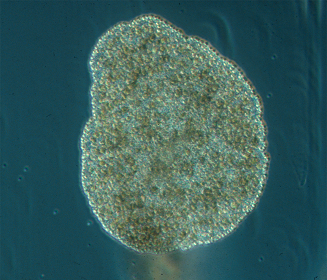 Trichoplax_adhaerens_photograph.png