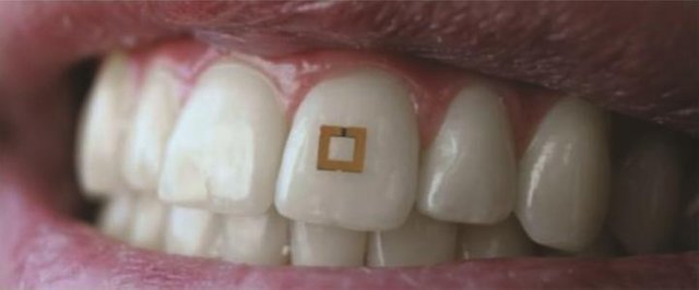 tooth-sensor.jpg