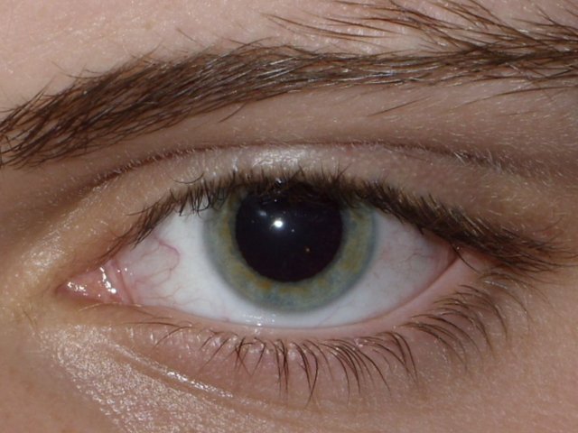 Result_of_Dilated_fundus_examination.jpg