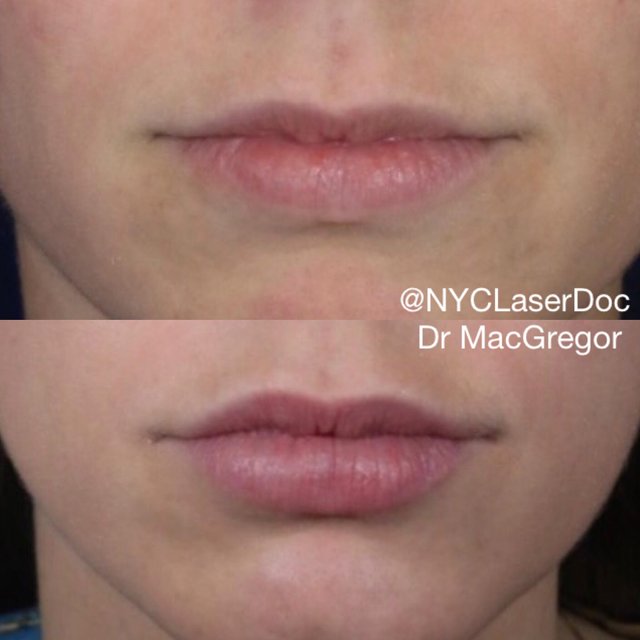 Lips2.jpg