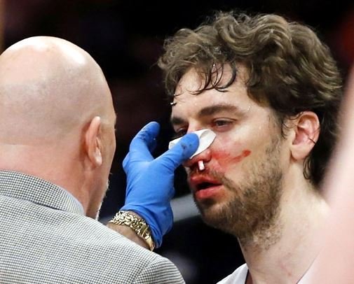 Pau-Gasol-Bloody-Nose.jpg