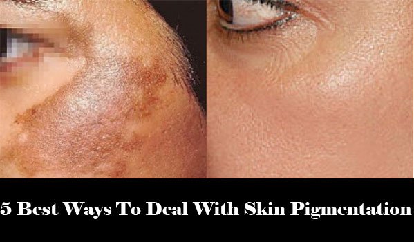 Skin-Pigmentation-Daytimes.jpg