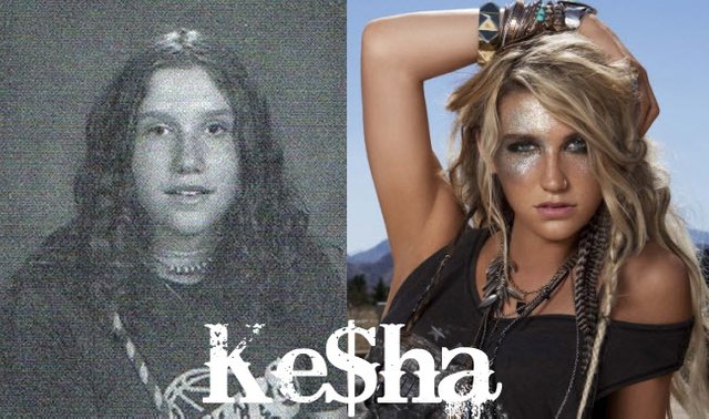 kesha-plastic_surgery.jpg