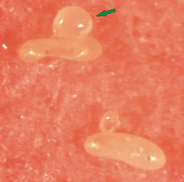 Fig-13-Female-physogastric-of-Adactylidium-gynaikothripsi-parasitizing-eggs-of.png