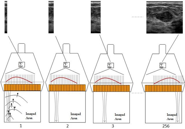 conventionalUltrasound.jpeg
