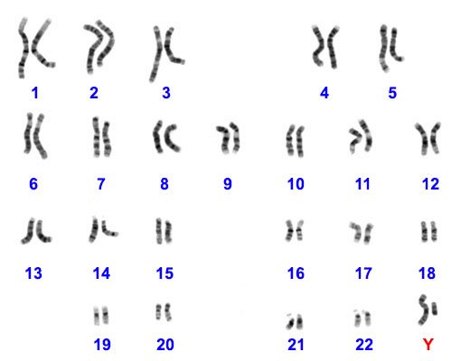765px-NHGRI_human_male_karyotype-.jpg