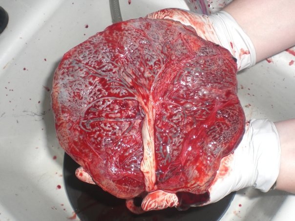 placenta.jpg