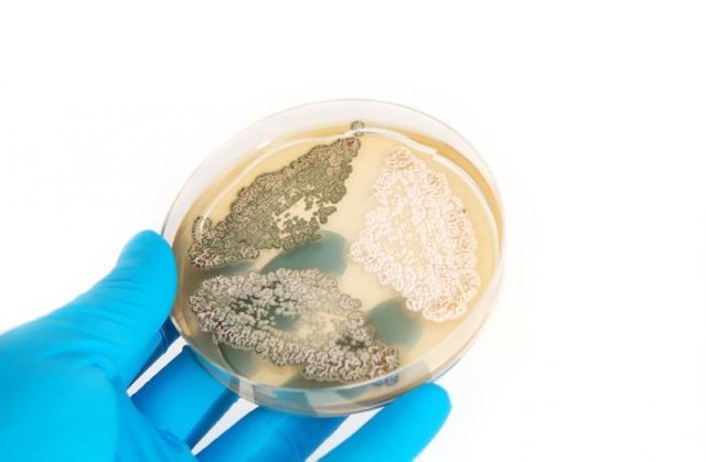 penicillin-growing-in-a-petri-dish.jpg