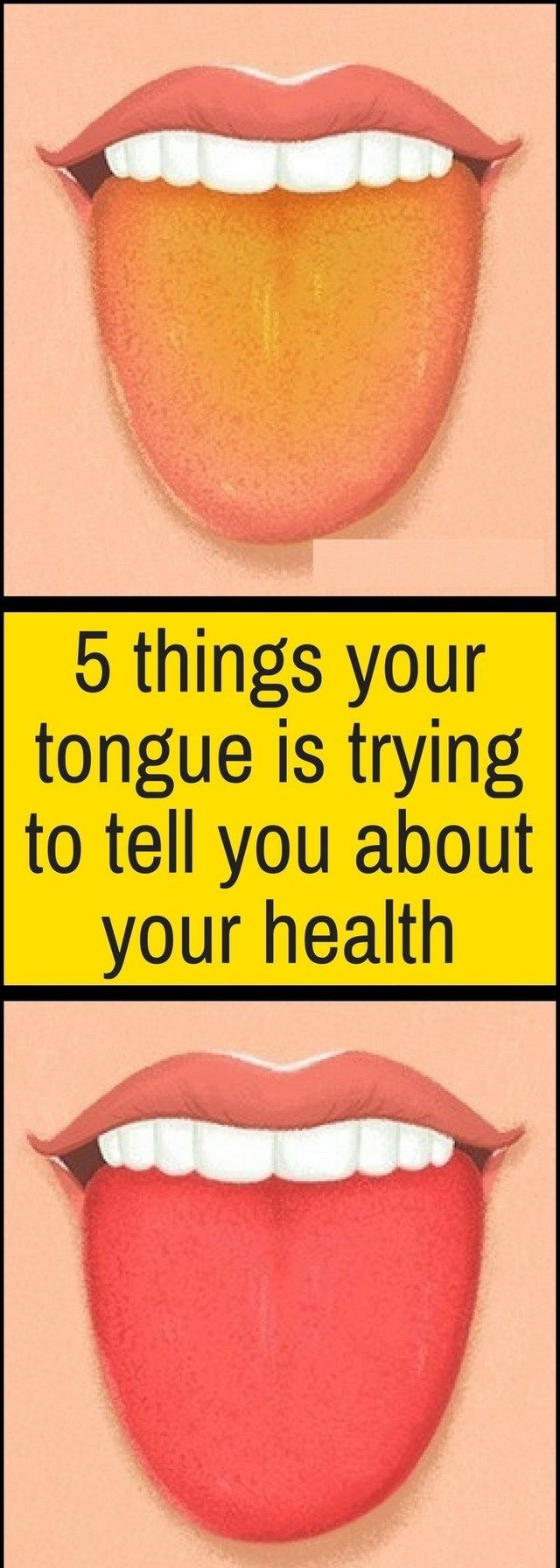 5-Things-Your-Tongue-Is-Trying-To-Tell-You-About-Your-Health-1.jpg