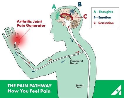 pain-pathway-diagram.jpg