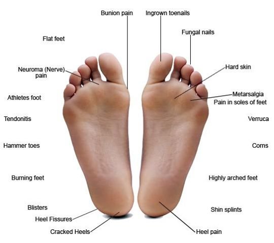 Diabetic-feet.jpg