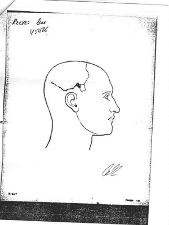 george-reeves-autopsy-report.png