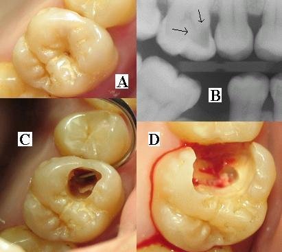 ToothMontage3.jpg