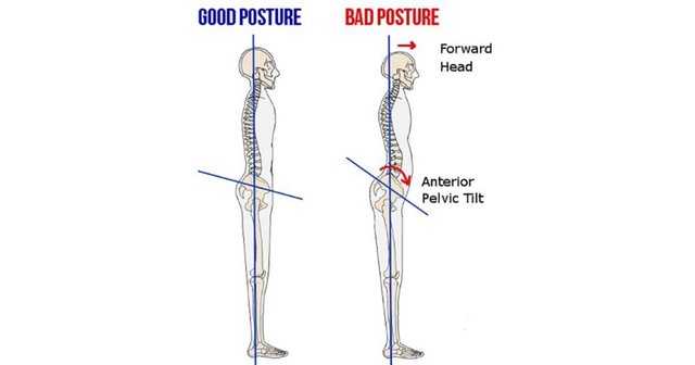 anterior-pelvic-tilt-1-918x482.jpg