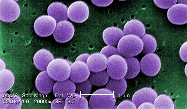Staphylococcus_aureus_VISA_2.jpg