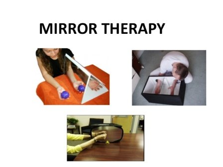 mirror-therapy-by-dr-rashi-goel-2-638.jpg