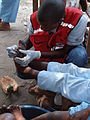 90px-Jigger_infested_feet_-_treatment.jpg