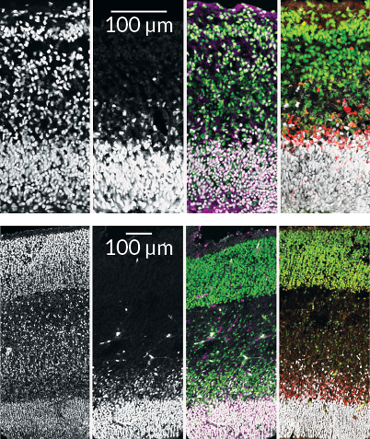 030318_organoids_inline_3_370.png