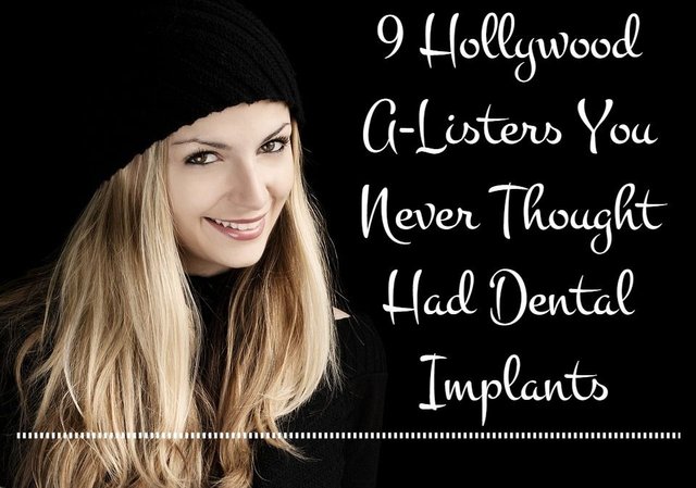 9 Hollywood A-Listers You Never Thought Had Dental Implants.jpg