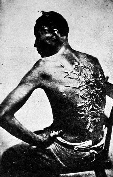 the-scarred-back-of-a-black-american-slave-after-a-whipping-baton-picture-id2668881.jpeg