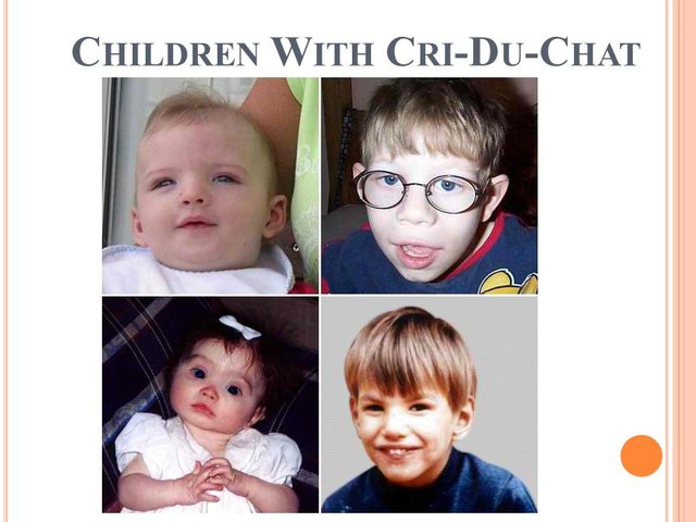 http___slideplayer.com_2558994_9_images_10_Children+With+Cri-Du-Chat.jpg