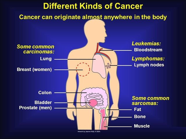signs-and-symptoms-of-cancer.jpg