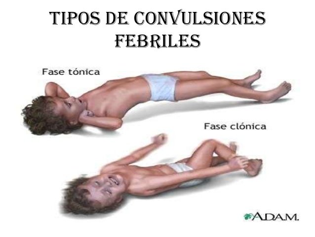 expo-convulsiones-febriles-5-638.jpg