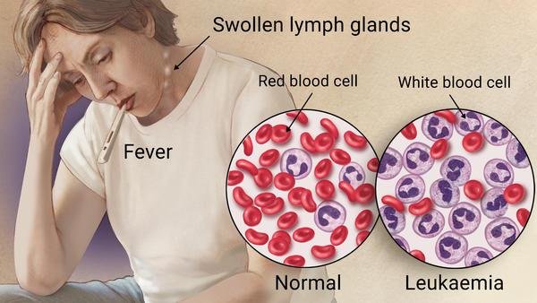 blood-cancer-in-india.jpg