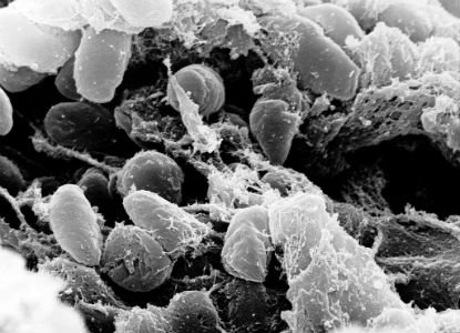 Yersinia Pestis.jpg