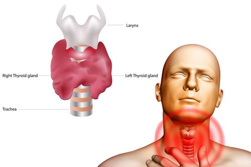 thyroid+pain.jpg