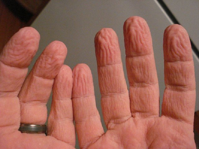 wrinkly_fingers(ukr.media).jpg